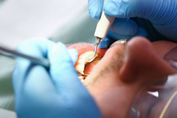 Best Urgent Dental Care for Toothaches in Fort Belvoir, VA