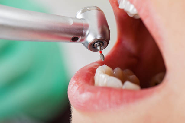 Best Emergency Treatment for Oral Infections in Fort Belvoir, VA